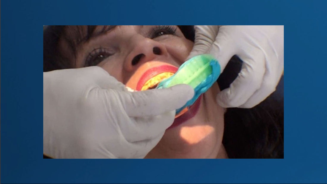 Taking the dental impression