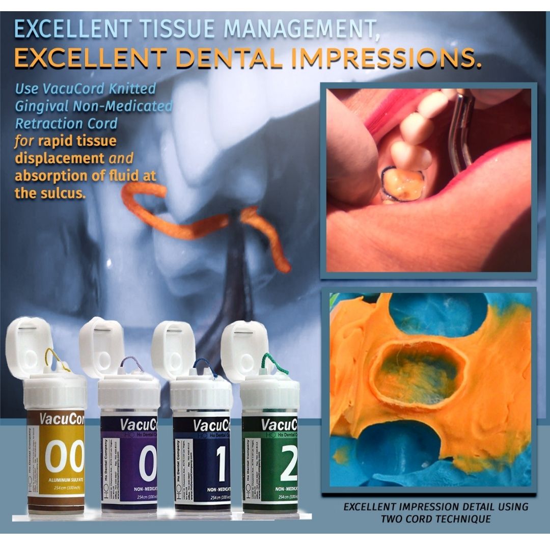 VacuCord knitted retraction cord is excellent for rapid tissue displacement and absorption of fluid at the sulcus.