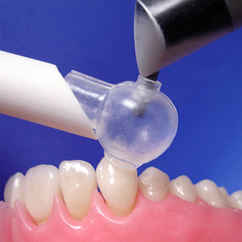 The Sand Trap Dental Sandblasting Device - product shot